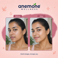 Anemone Gluta+