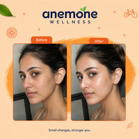 Anemone All-In-One Multivitamin Gummies