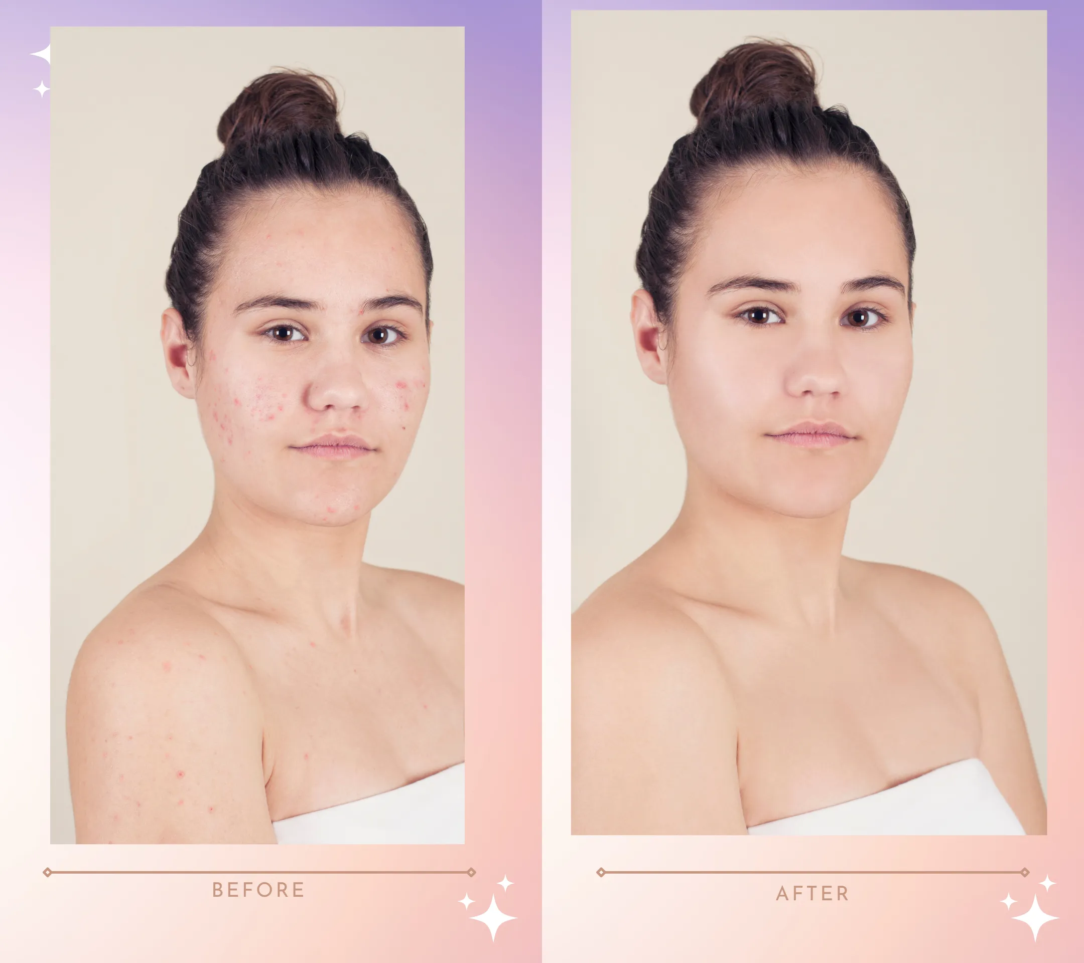beforevsafter